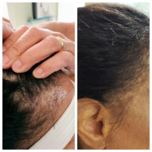 new river women's health hair restoration