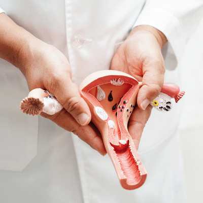 Doctor holding plastic illustration of female reproduction organs, representing stigma in menstrual health 